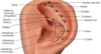 LA AURICULOTERAPIA